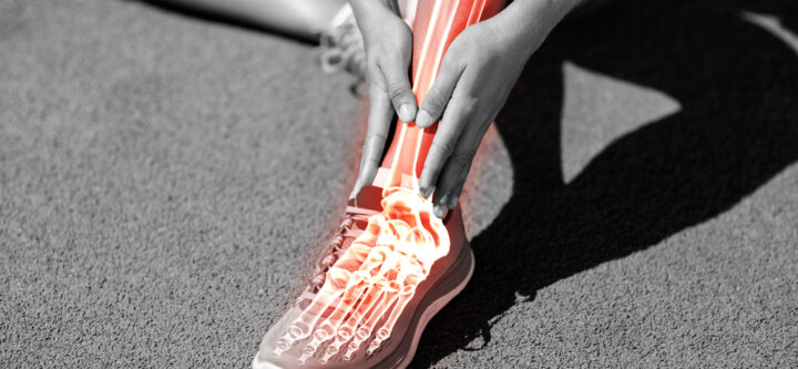 Low,Section,Of,Female,Athlete,Suffering,From,Pain,On,Track