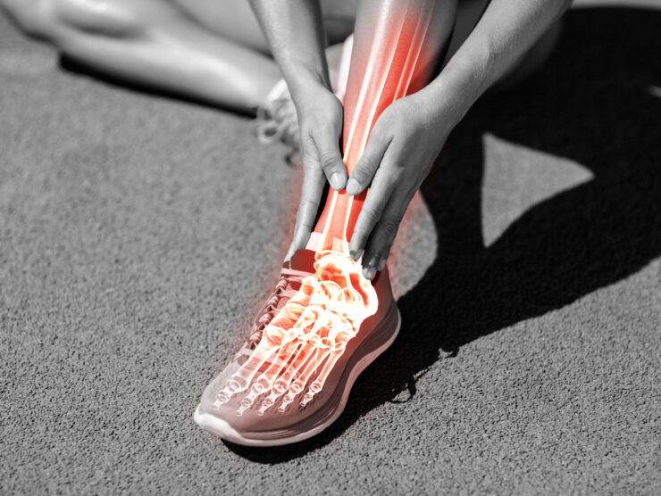 Low,Section,Of,Female,Athlete,Suffering,From,Pain,On,Track