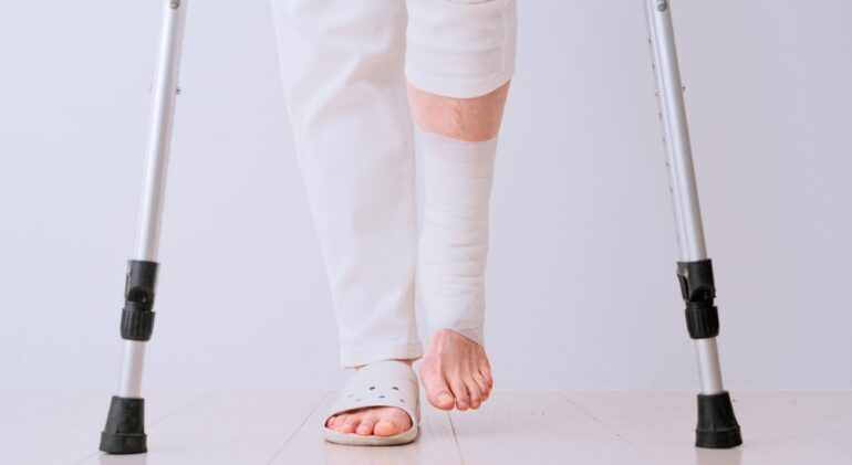 Medical,Image,Of,Middle,Woman,On,Crutches