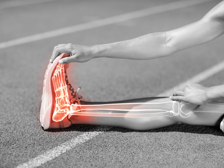 Low,Section,Of,Sportswoman,Stretching,On,Sports,Track,During,Sunny